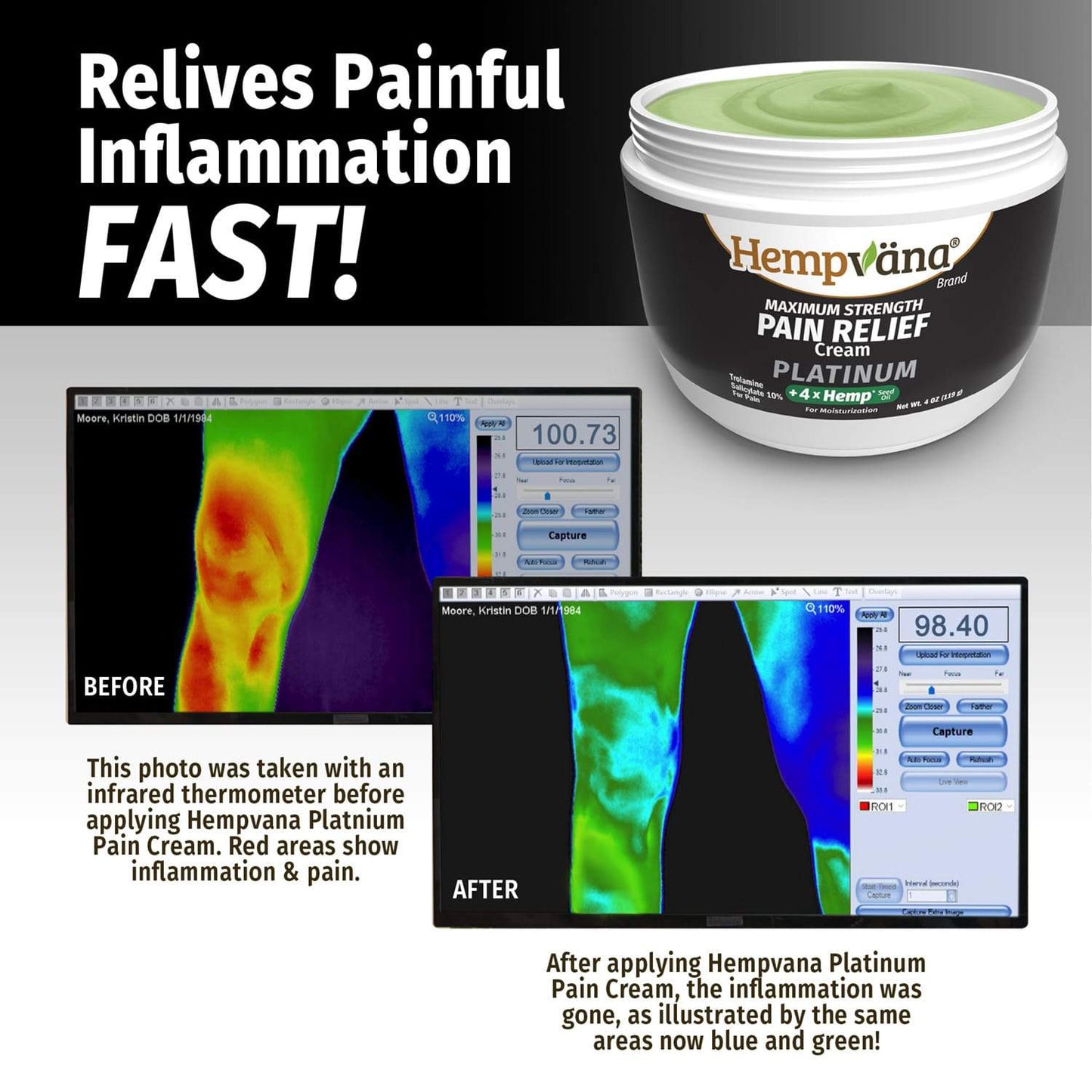 Relief painful inflammation fast! Shows Platinum Pain Relief Jar and before infrared thermometer photo with red areas shows inflammation and pain and after showing blue and green for relief